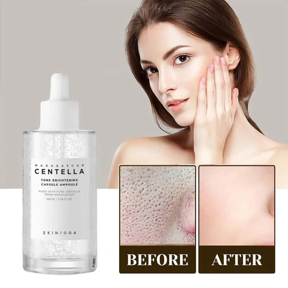 Centella Asiatica Serum & Toner – Sérum et Tonique Hydratant et Éclaircissant